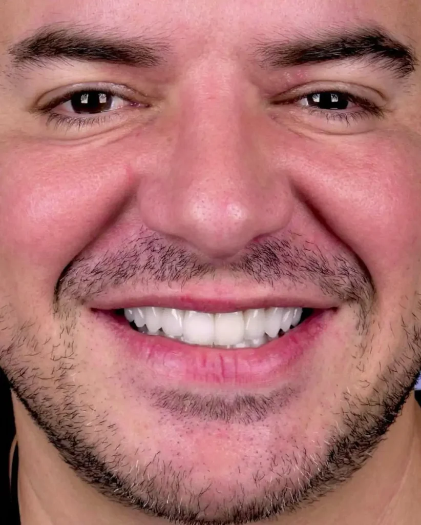 Sorriso_4.2