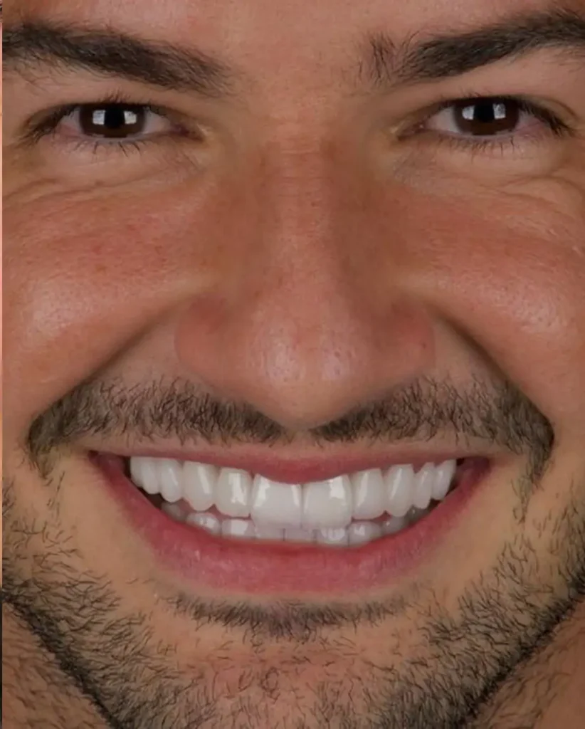 Sorriso_Pato_2.2