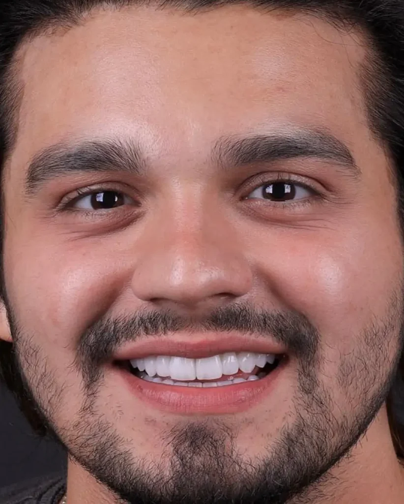 luan